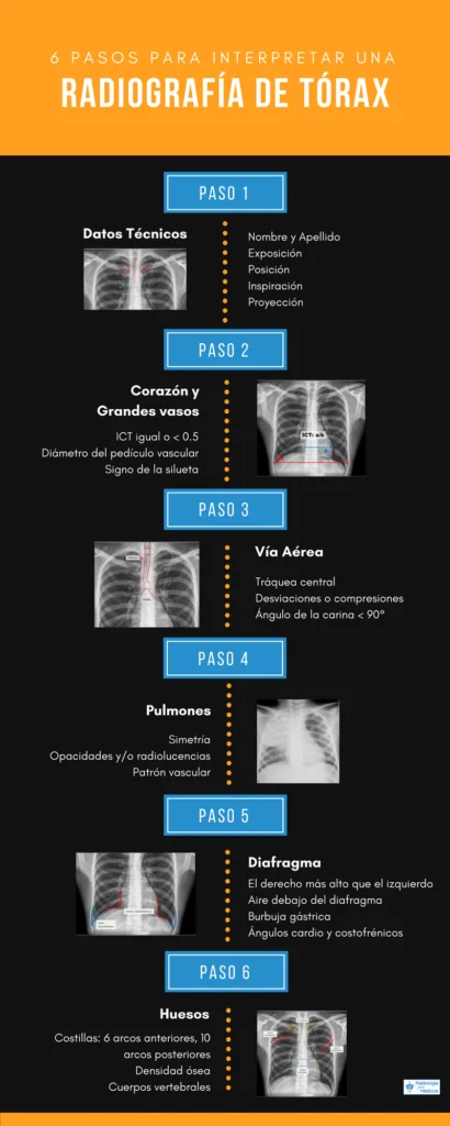 Cómo leer una radiografía de tórax en 6 pasos Cómo leer una radiografía de tórax en 6 pasos