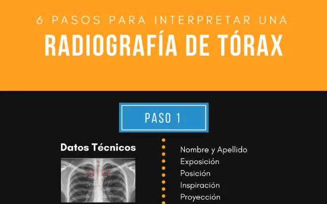 destacada-como-leer-rx-torax