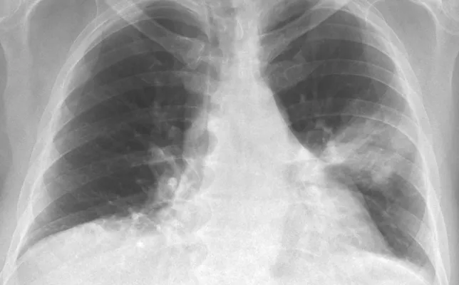 Imagen destacada- consolidacion