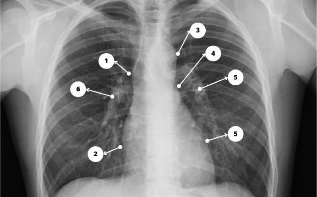 Imagen destacada - silueta cardiovascular