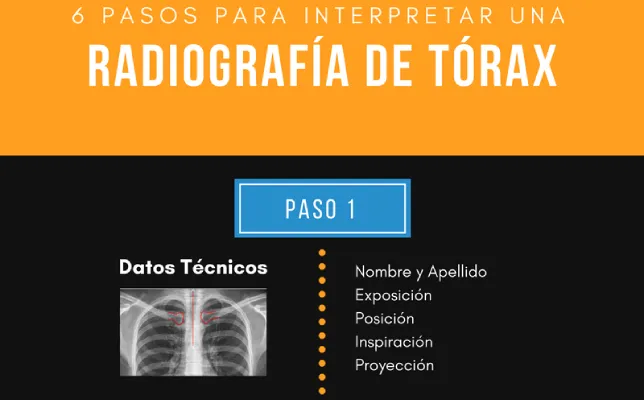 Imagen destacada - Rx torax en 6 pasos