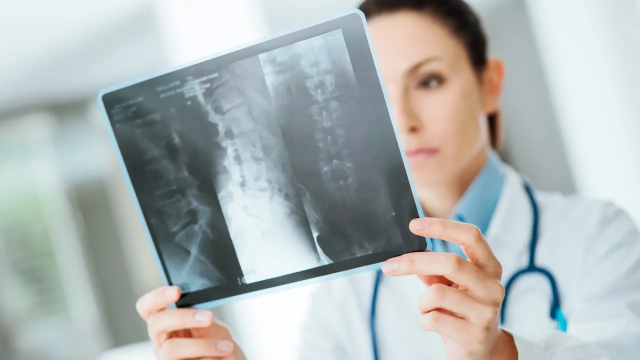 radiografia-columna-destacada