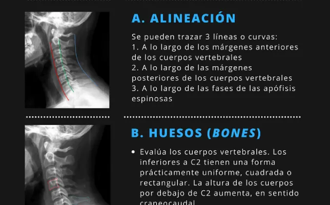 Imagen destacada - radiografia columna cervical