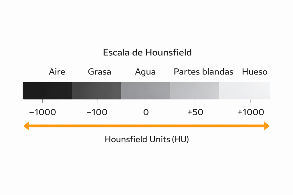 Escala de Hounsfield.