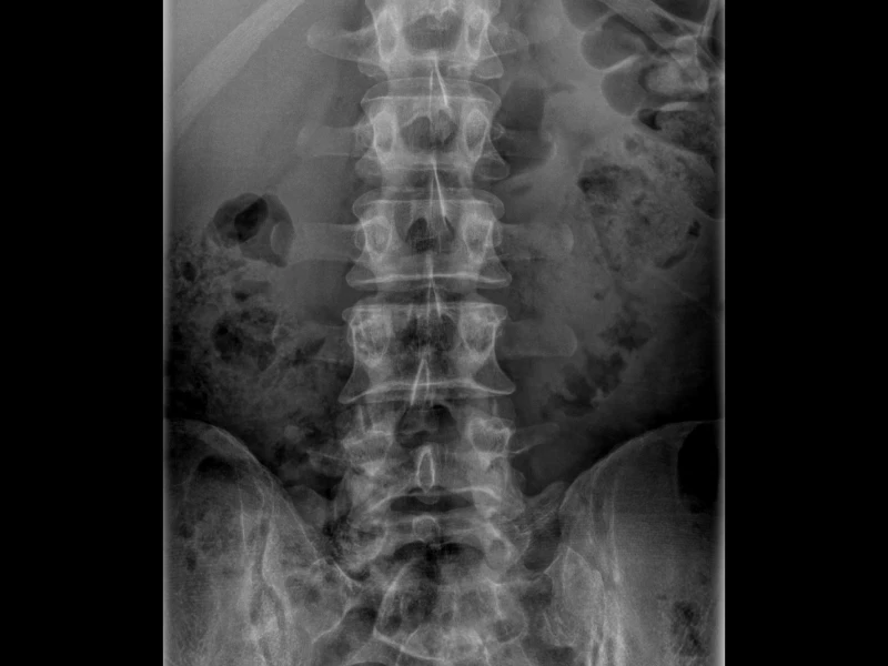 destacada-M36-col-lumbar