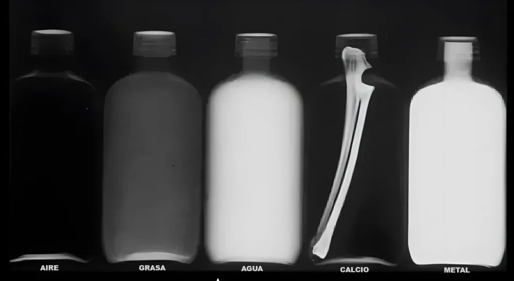 5-densidades-radiologicas-basicas