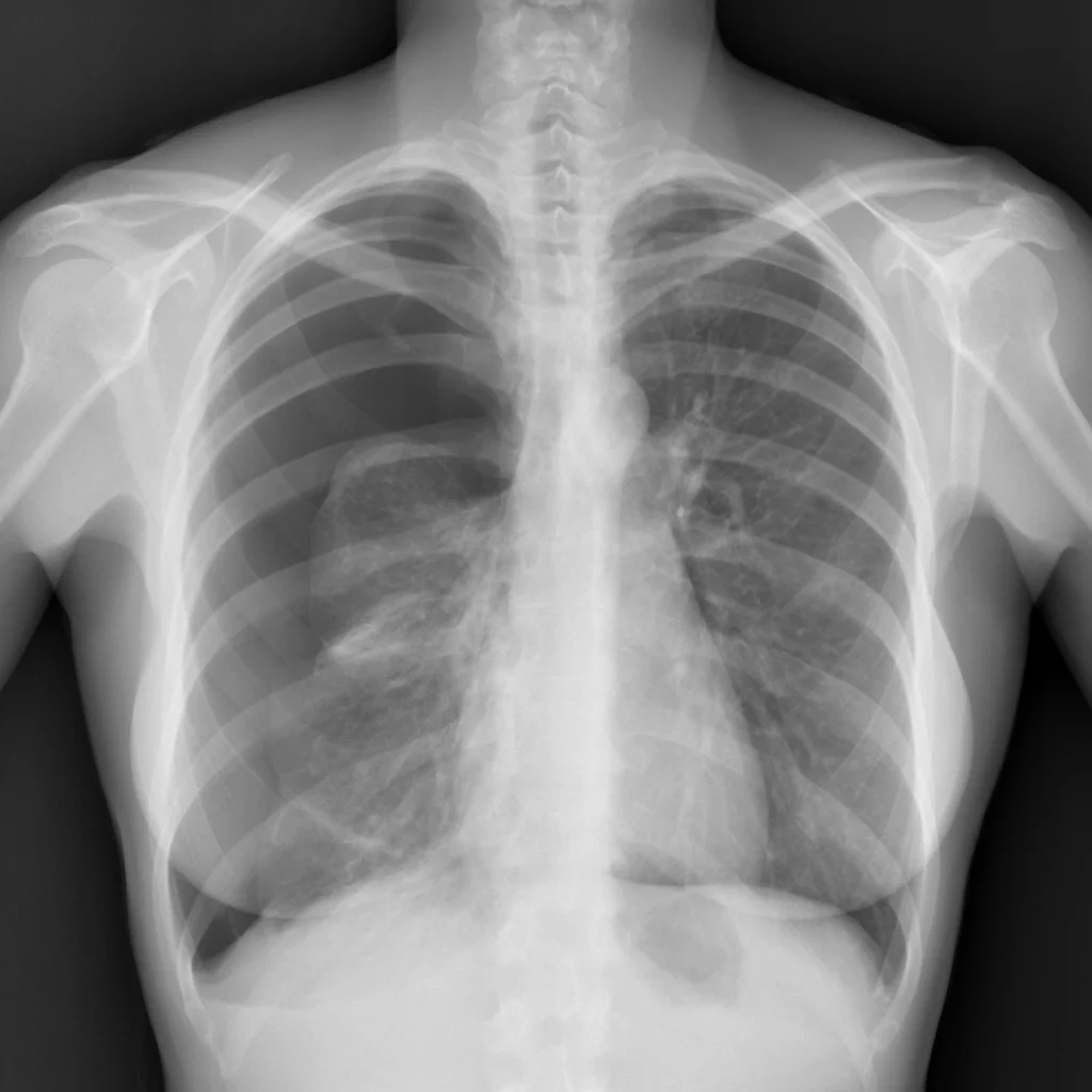 PNX-derecho-inspiracion PNX-derecho-inspiracion