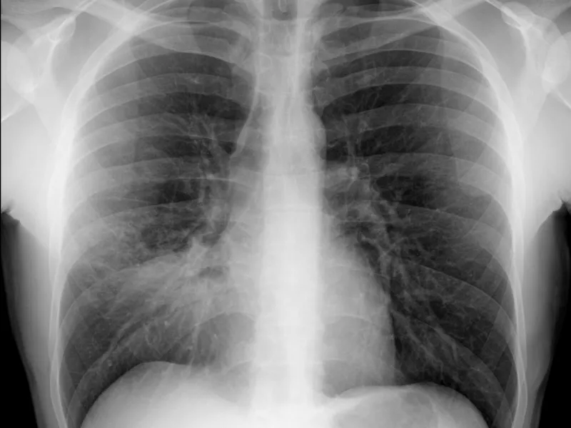 consolidacion_LM_destacada