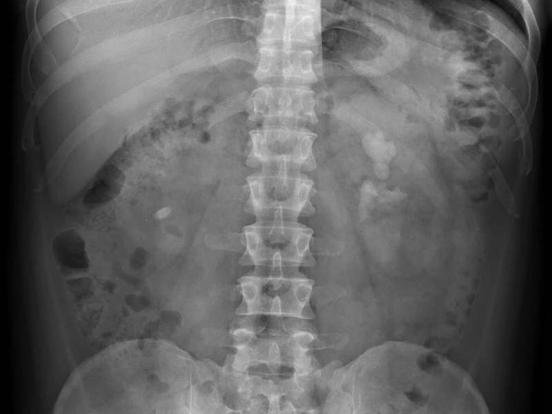 Lito-coraliforme-destacada