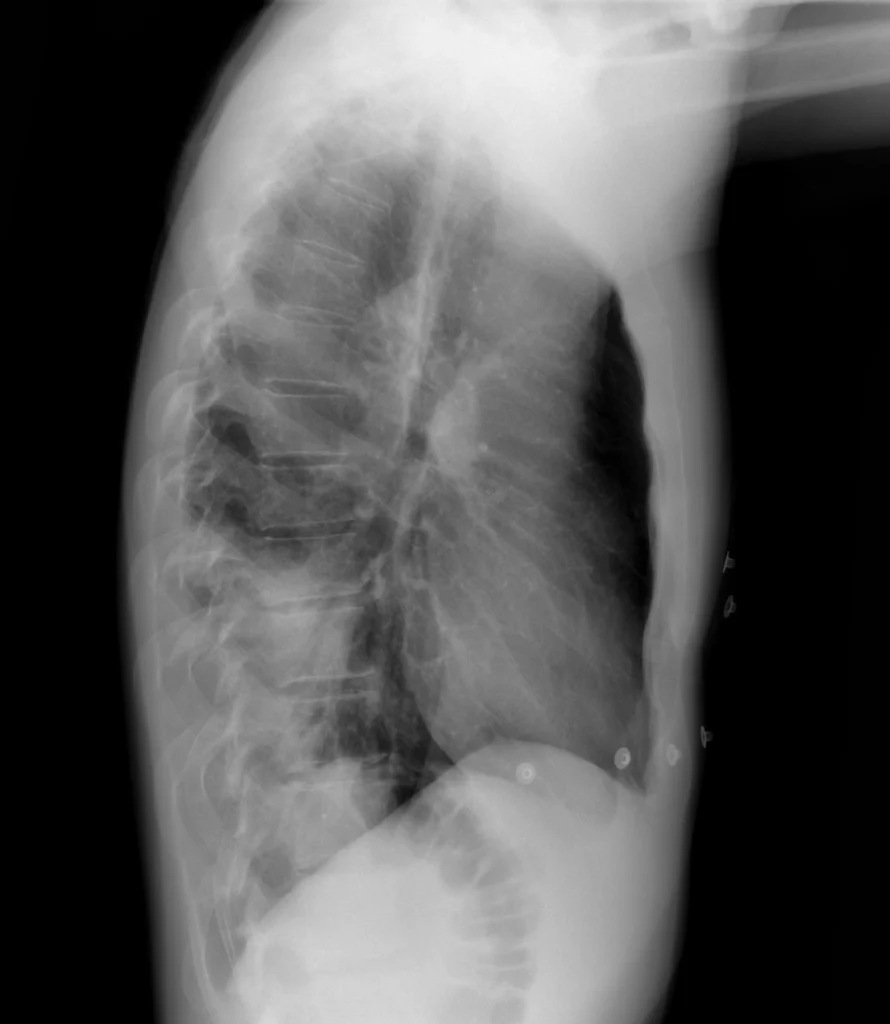 M44-ConsolidacionLII-2 Signo de la silueta negativo - LL - Consolidacion LII
