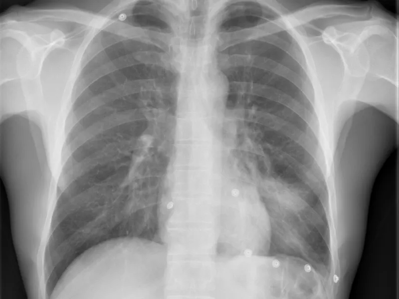 ConsolidacionLII-destacada