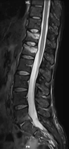 F52-rm-sag-stir-fx-D12-L1