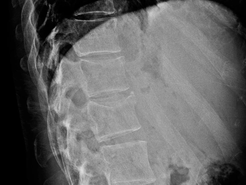 F52-fx-D12 y L1-destacada